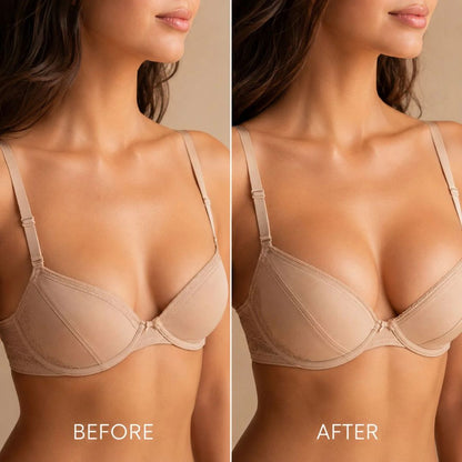 Proxy™ Breast Enhance Mentmicroneedle Patch
